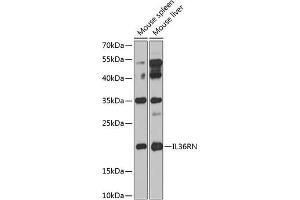 Western blot analysis of extracts of various cell lines, using IL36RN antibody (ABIN6132859, ABIN6142394, ABIN6142395 and ABIN6224229) at 1:1000 dilution. (FIL1d 抗体  (AA 1-155))