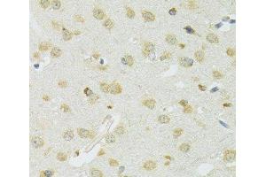 Immunohistochemistry of paraffin-embedded Mouse brain using SLC37A4 Polyclonal Antibody at dilution of 1:100 (40x lens). (SLC37A4 抗体)