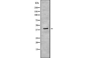 Western blot analysis of PYGO2 using HuvEc whole cell lysates (PYGO2 抗体  (N-Term))