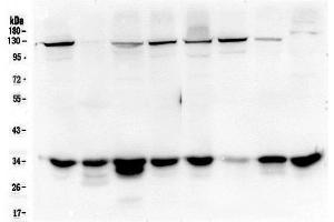 Western blot analysis of AMPK beta 2 using anti-AMPK beta 2 antibody (ABIN5693058).