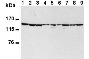 Western Blotting (WB) image for anti-Splicing Factor 3b, Subunit 1, 155kDa (SF3B1) (AA 98-198) antibody (ABIN1449241) (SF3B1 抗体  (AA 98-198))