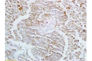 Formalin-fixed and paraffin embedded rat lung labeled with Anti-Claudin-4 Polyclonal Antibody, Unconjugated  at 1:200 followed by conjugation to the secondary antibody and DAB staining (Claudin 4 抗体  (AA 21-120))