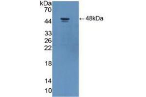 Western blot analysis of recombinant Human ADIPOR2. (Adiponectin Receptor 2 抗体  (AA 2-155))