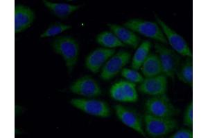IF analysis of PC-3 cells, using SLN antibody (1/50 dilution) and AF488-conjugated Goat anti-Rabbit IgG (H+L). (SLN 抗体)