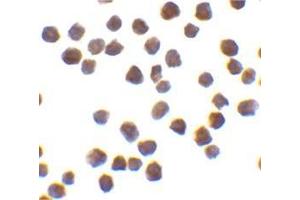 Immunocytochemistry of TRAF6 in K562 cells with this product at 0. (TRAF6 抗体  (C-Term))