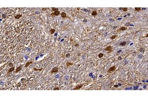 Immunohistochemistry (IHC) image for anti-S100 Calcium Binding Protein B (S100B) (AA 1-92) antibody (ABIN7432076)
