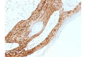 Immunohistochemistry (IHC) image for anti-Cadherin 1, Type 1, E-Cadherin (Epithelial) (CDH1) antibody (ABIN4949629)