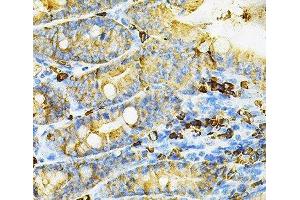 Immunohistochemistry of paraffin-embedded Mouse intestine using HGF Polyclonal Antibody at dilution of 1:100 (40x lens). (HGF 抗体)