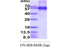 SDS-PAGE (SDS) image for Retinoic Acid Early Transcript 1E (RAET1E) (AA 31-225) protein (hIgG-His-tag) (ABIN5854981) (Retinoic Acid Early Transcript 1E (RAET1E) (AA 31-225) protein (hIgG-His-tag))