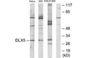 Western blot analysis of extracts from HeLa/293/COLO205 cells, using DLX5 Antibody. (DLX5 抗体  (AA 91-140))