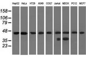 Western blot analysis of extracts (35 µg) from 9 different cell lines by using anti-C9orf41 monoclonal antibody. (C9orf41 抗体)