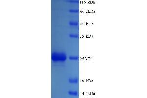 SDS-PAGE (SDS) image for Ribose 5-Phosphate Isomerase A (RPIA) (AA 1-219), (full length) protein (ABIN5714306) (Ribose 5-Phosphate Isomerase A (RPIA) (AA 1-219), (full length) 蛋白)