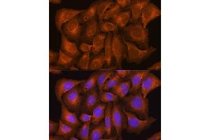Immunofluorescence analysis of U2OS cells using NCSTN Rabbit pAb (ABIN7268905) at dilution of 1:100. (Nicastrin 抗体  (AA 429-669))