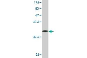 Western Blot detection against Immunogen (36. (CHRAC1 抗体  (AA 1-96))