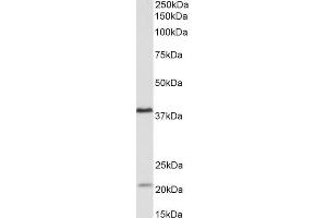 KLHDC8B 抗体  (Internal Region)