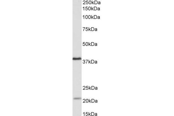 KLHDC8B 抗体  (Internal Region)