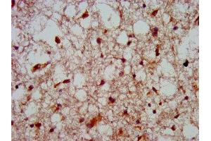 IHC image of ABIN7155717 diluted at 1:800 and staining in paraffin-embedded human brain tissue performed on a Leica BondTM system. (HOXA4 抗体  (AA 23-173))