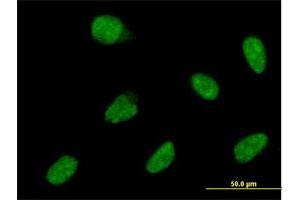 Immunofluorescence of monoclonal antibody to ATOH1 on HeLa cell. (ATOH1 抗体  (AA 266-354))