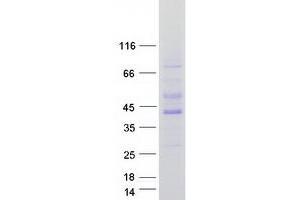 Validation with Western Blot