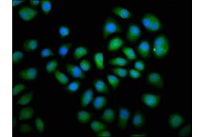 Immunofluorescence staining of Hela cells with ABIN7150781 at 1:66, counter-stained with DAPI. (DUSP6 抗体  (AA 100-206))