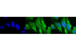 Immunocytochemistry/Immunofluorescence analysis using Mouse Anti-HO-1 Monoclonal Antibody, Clone 1F12-A6 (ABIN361696 and ABIN361697). (HMOX1 抗体  (AA 1-30))