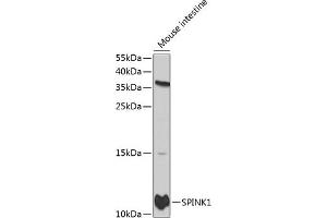 Western Blotting (WB) image for anti-serine Peptidase Inhibitor, Kazal Type 1 (SPINK1) (AA 24-79) antibody (ABIN3021427)