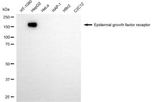 Western blotting analysis using epidermal growth factor receptor antibody (ABIN7798475).