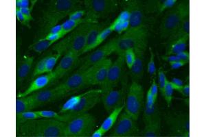 Immunofluorescent staining of SK-N-SH cells (Human neuroblastoma, ATCC HTB-11) (right). (Dynactin 1 抗体  (AA 3-202))