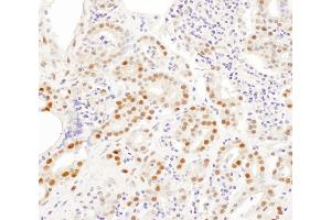 Immunohistochemistry (IHC) image for anti-Small Nuclear Ribonucleoprotein Polypeptide A (SNRPA) (AA 205-255) antibody (ABIN7453449)