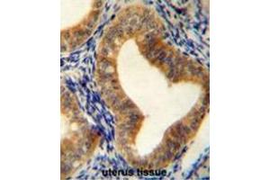 AHCY Antibody (N-term) immunohistochemistry analysis in formalin fixed and paraffin embedded human uterus tissue followed by peroxidase conjugation of the secondary antibody and DAB staining. (AHCY 抗体  (N-Term))