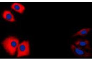 Immunofluorescent analysis of Caspase 1 p10 staining in HeLa cells. (Caspase 1 (p10) 抗体  (C-Term))
