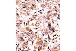 Image no. 1 for anti-WEE1 Homolog (S. Pombe) (WEE1) (pSer123) antibody (ABIN358251) (WEE1 抗体  (pSer123))