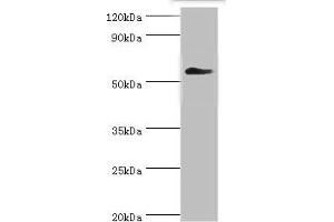 Western blot All lanes: T-complex protein 1 subunit gamma antibody at 12 μg/mL + Mouse brain tissue Secondary Goat polyclonal to rabbit IgG at 1/10000 dilution Predicted band size: 61, 57 kDa Observed band size: 61 kDa (CCT3 抗体  (AA 1-300))