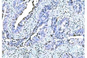 IHC analysis of KAT3B/P300/EP300 using anti-KAT3B/P300/EP300 antibody (ABIN7603064).