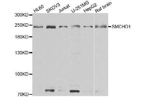 Western blot analysis of extracts of various cell lines, using SMCHD1 antibody. (SMCHD1 抗体  (AA 1756-2005))