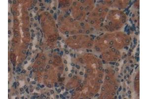 Immunohistochemistry (IHC) image for anti-Collagen, Type I, alpha 1 (COL1A1) (AA 1225-1453) antibody (ABIN7431647)
