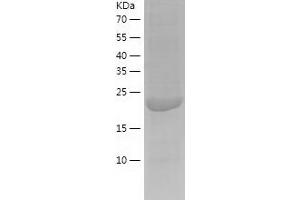 Western Blotting (WB) image for Calcyphosine-Like (CAPSL) (AA 1-208) protein (His tag) (ABIN7122097) (CAPSL Protein (AA 1-208) (His tag))