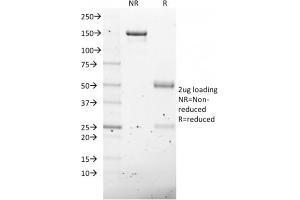 SDS-PAGE Analysis Purified NKX2. (NKX2-8 抗体  (AA 10-123))