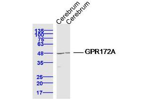 Lane 1: Cerebrum lysates Lane 2: Cerebrum lysates probed with GPR172A Polyclonal Antibody, Unconjugated  at 1:300 dilution and 4˚C overnight incubation. (GPR172A 抗体  (AA 101-200))