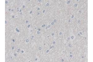 Detection of CUL9 in Human Cerebrum Tissue using Polyclonal Antibody to Cullin 9 (CUL9) (CUL9 抗体  (AA 1144-1322))