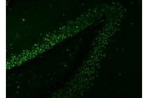 IF analysis of SNRNP27 using anti-SNRNP27 antibody (ABIN7599614).