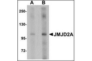 Western blot analysis of JMJD2A in rat liver tissue lysate with this product at (A) 1 and (B) 2 μg/ml. (KDM4A 抗体  (Center))