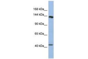 Image no. 1 for anti-Slit Homolog 1 (SLIT1) (AA 1439-1488) antibody (ABIN6744315) (SLIT1 抗体  (AA 1439-1488))