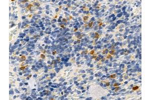 ABIN7093299 and ABIN7097318 at 1/100 staining Rat spleen tissue by IHC-P. (CD22 抗体  (pTyr807))
