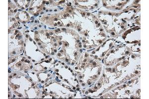 Immunohistochemical staining of paraffin-embedded Human prostate tissue using anti-USP5 mouse monoclonal antibody. (USP5 抗体)