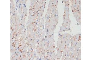 Immunohistochemistry of paraffin-embedded Rat heart using CD36 Polyclonal Antibody at dilution of 1:200 (40x lens). (CD36 抗体)