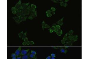 Immunofluorescence analysis of HeLa cells using Phospho-AKT(T308) Polyclonal Antibody at dilution of 1:100. (AKT1 抗体  (pThr308))