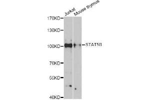 Western blot analysis of extracts of various cell lines, using STAT5B antibody (ABIN5998982) at 1:3000 dilution. (STAT5B 抗体)
