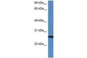 Image no. 1 for anti-RAB27B, Member RAS Oncogene Family (RAB27B) (AA 122-171) antibody (ABIN6747242) (RAB27B 抗体  (AA 122-171))