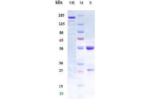 Anti-RGMA Reference Antibody (elezanumab) on SDS-PAGE under reducing (R) condition.